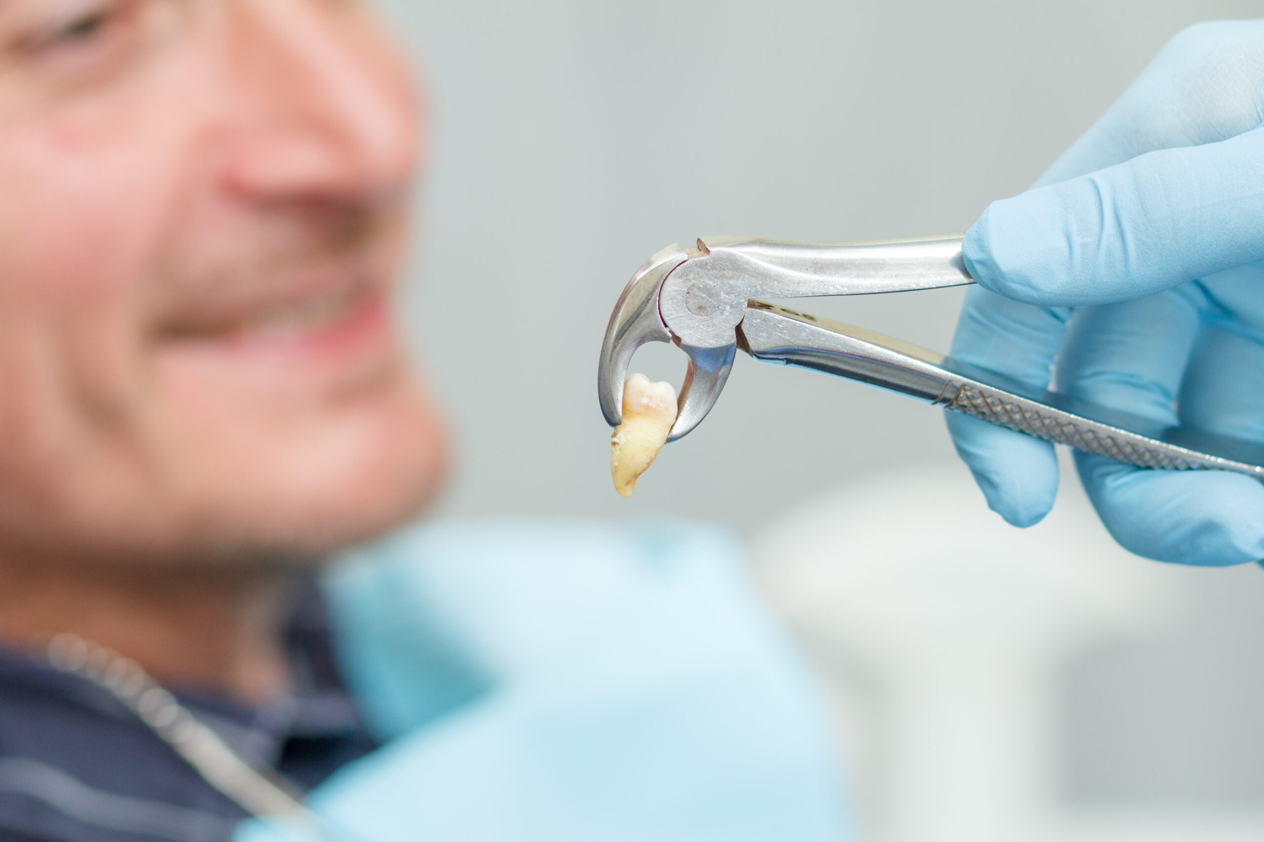 Extractions