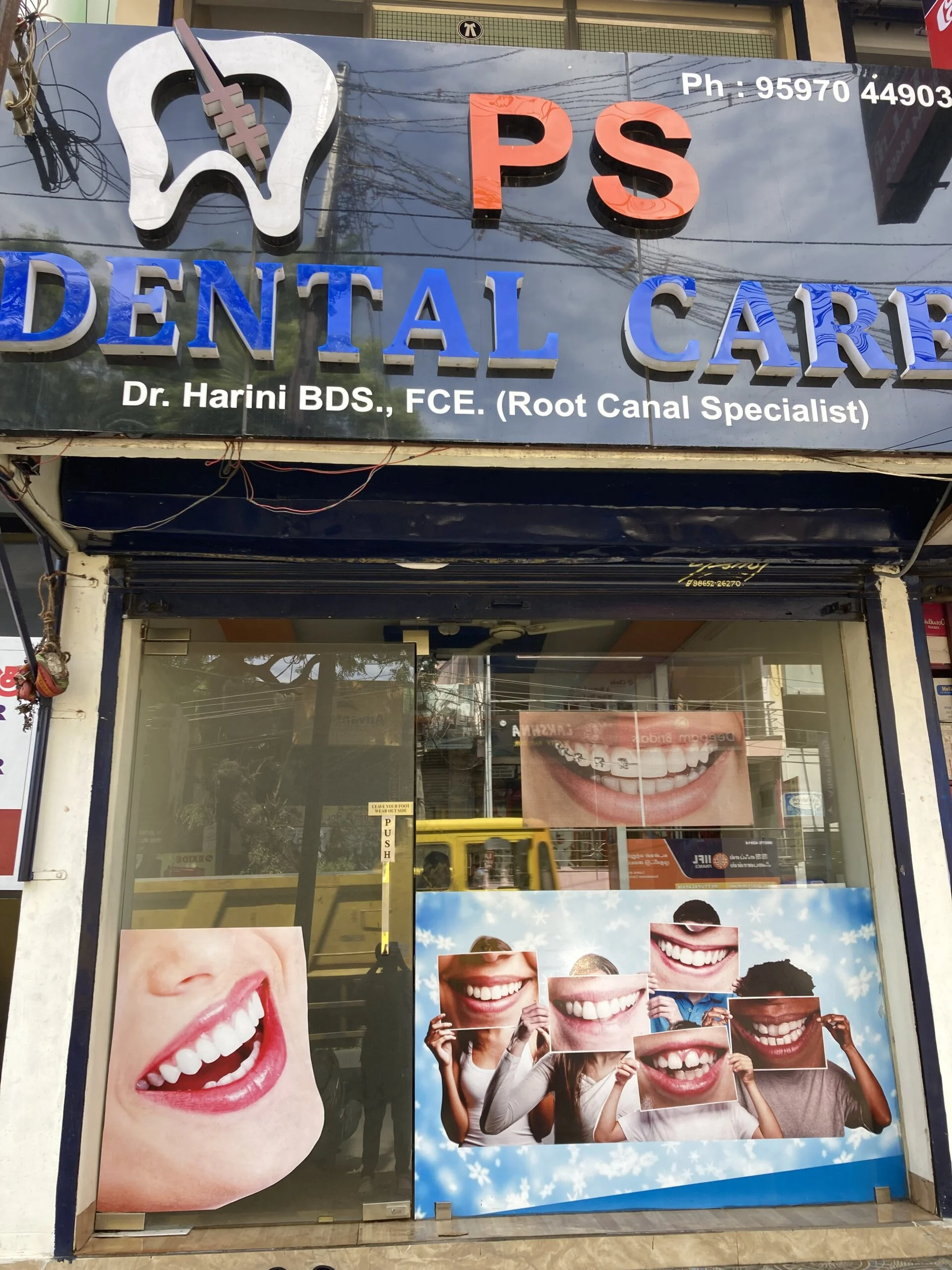 tooth bleaching in Dwarka An Incredibly Easy Method That Works For All